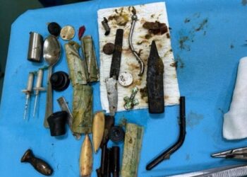 Medicii au găsit în stomacul unui ieșean „cuţite, bancnote, monezi, o cruciuliţă, un centimetru, o lingură de metal și un cap de ciocan!”