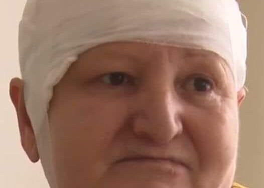 Femeie orba, operata pe creier cu succes!