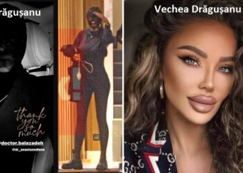 Bianca Drăgușanu e „omul negru” prin oraș! Umblă cu cagula pe față ca să-și ascundă vânătăile! „M-am umflat…”
