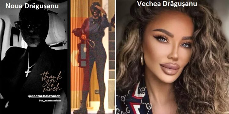 Bianca Drăgușanu e „omul negru” prin oraș! Umblă cu cagula pe față ca să-și ascundă vânătăile! „M-am umflat…”