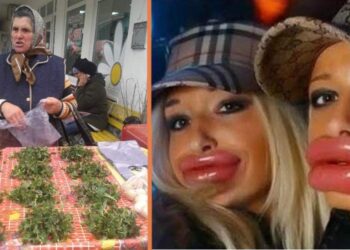 Româncele care n-au bani de botox, se freacă cu urzici pe buze!