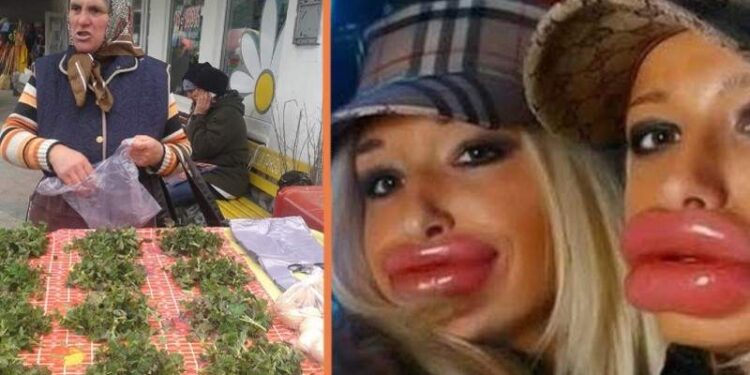 Româncele care n-au bani de botox, se freacă cu urzici pe buze!